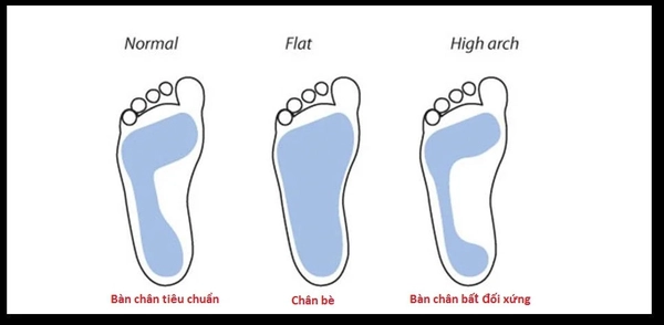 Cách nhận biết chân bè rộng