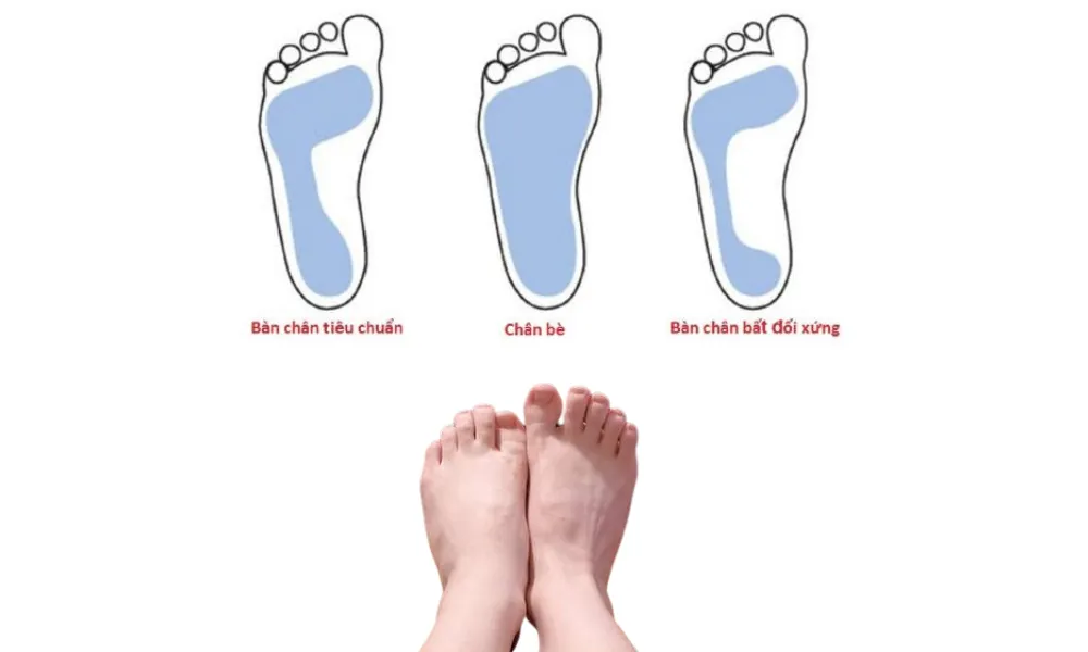 Cách chọn giày cho người chân bè rộng dễ đi và thoải mái