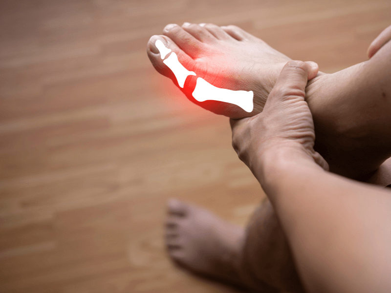 Cách chọn giày để hạn chế đau đầu ngón chân